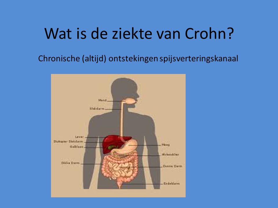 Wat is de ziekte van Crohn