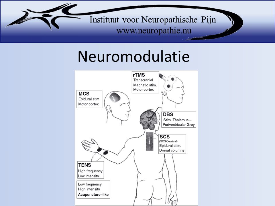 Neuromodulatie