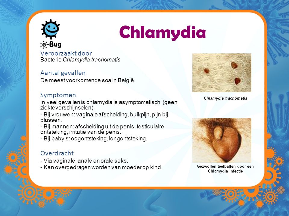 Chlamydia trachomatis Gezwollen teelballen door een Chlamydia infectie