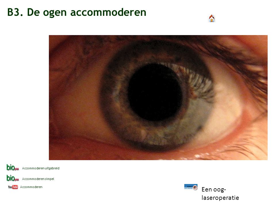 B3. De ogen accommoderen Een oog-laseroperatie Accommoderen uitgebreid