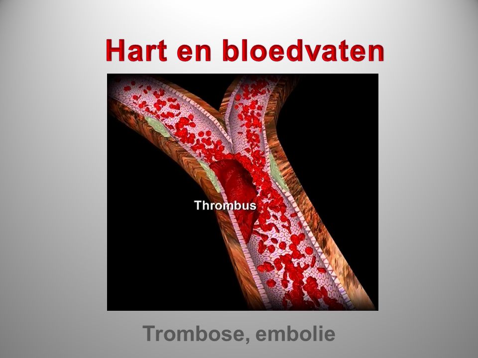Hart en bloedvaten Trombose, embolie