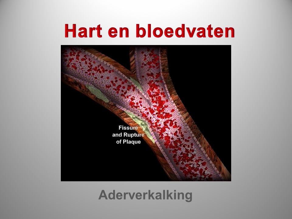 Hart en bloedvaten Aderverkalking