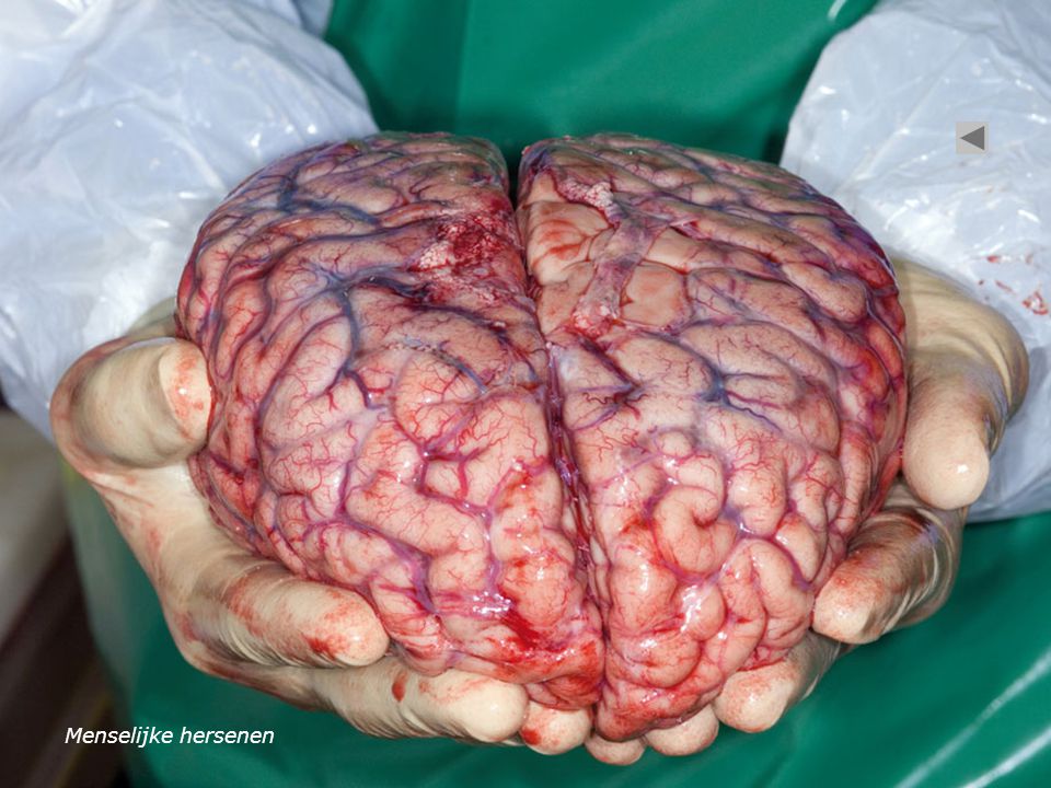 Menselijke hersenen