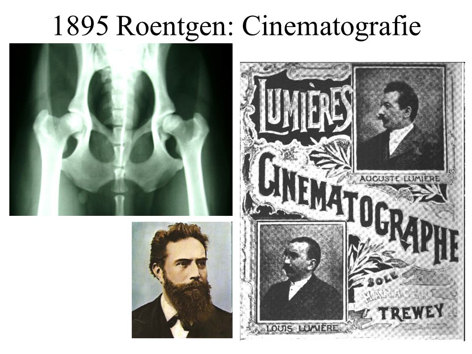 1895 Roentgen: Cinematografie