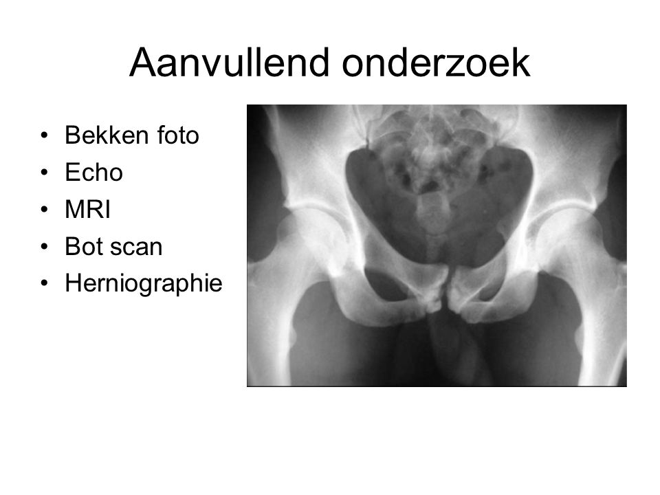 Aanvullend onderzoek Bekken foto Echo MRI Bot scan Herniographie