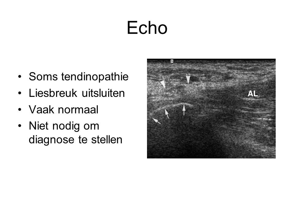 Echo Soms tendinopathie Liesbreuk uitsluiten Vaak normaal