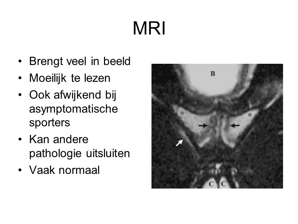 MRI Brengt veel in beeld Moeilijk te lezen