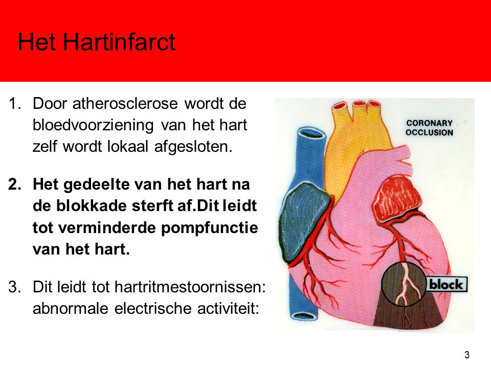 Het Hartinfarct Door atherosclerose wordt de bloedvoorziening van het hart zelf wordt lokaal afgesloten.