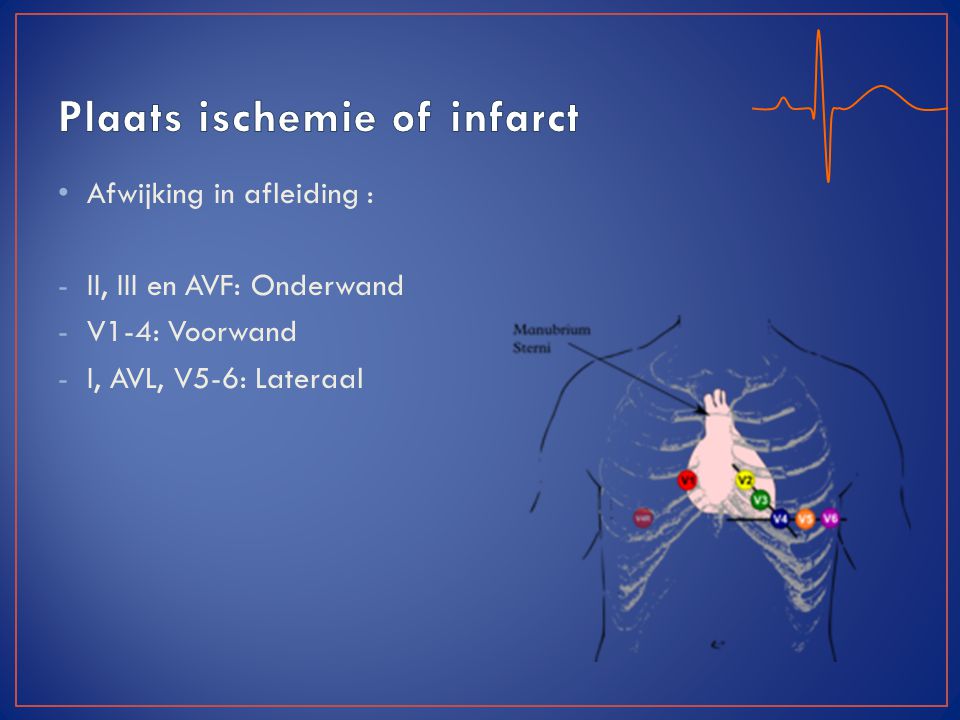 Plaats ischemie of infarct