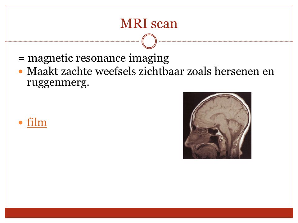 MRI scan = magnetic resonance imaging