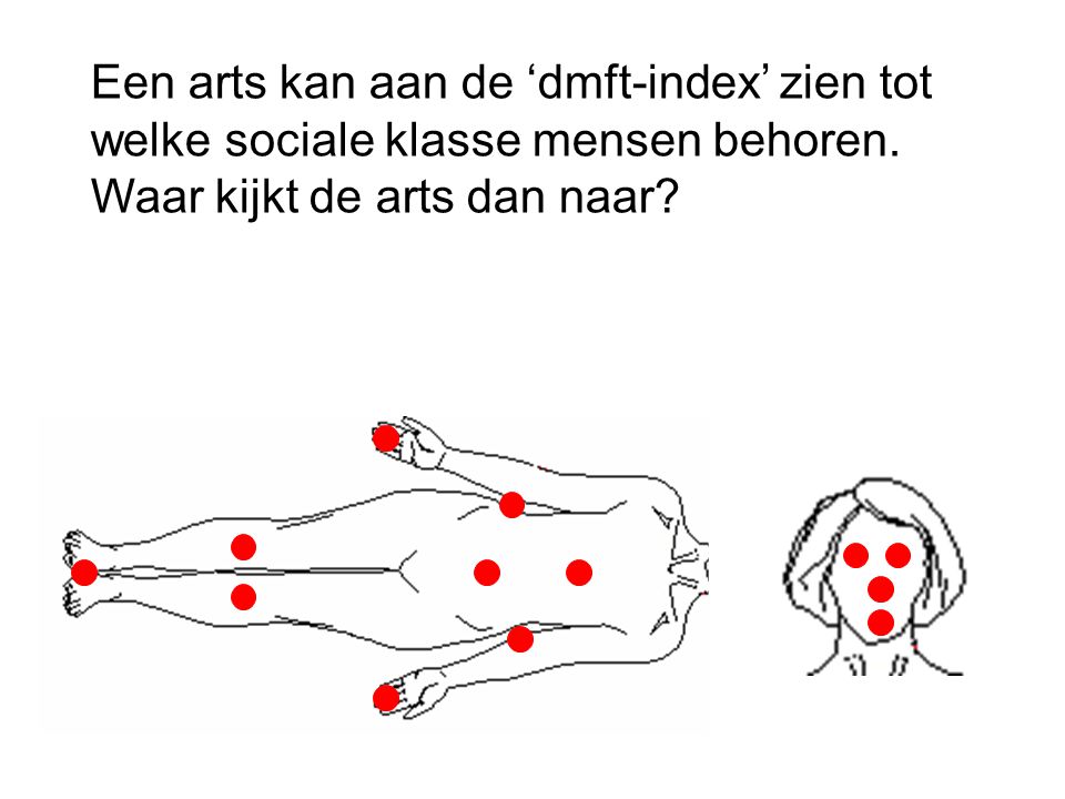 Een arts kan aan de ‘dmft-index’ zien tot welke sociale klasse mensen behoren.
