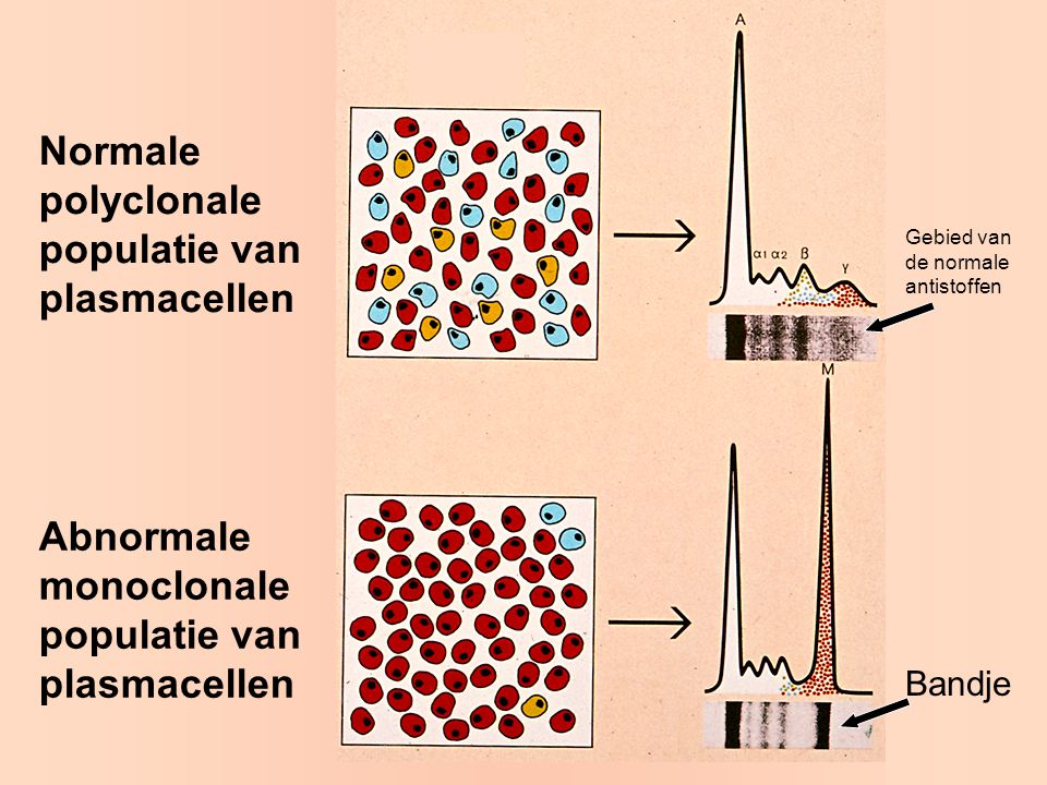 Normale polyclonale populatie van plasmacellen
