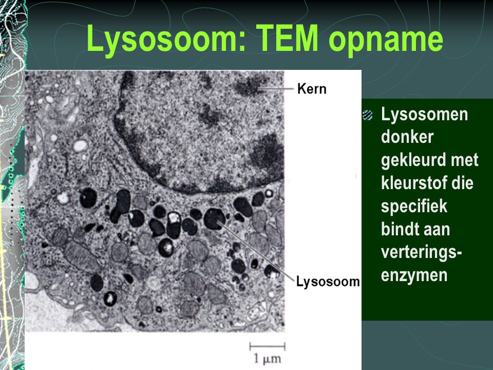 Lysosoom: TEM opname Lysosomen donker gekleurd met kleurstof die specifiek bindt aan verterings-enzymen.