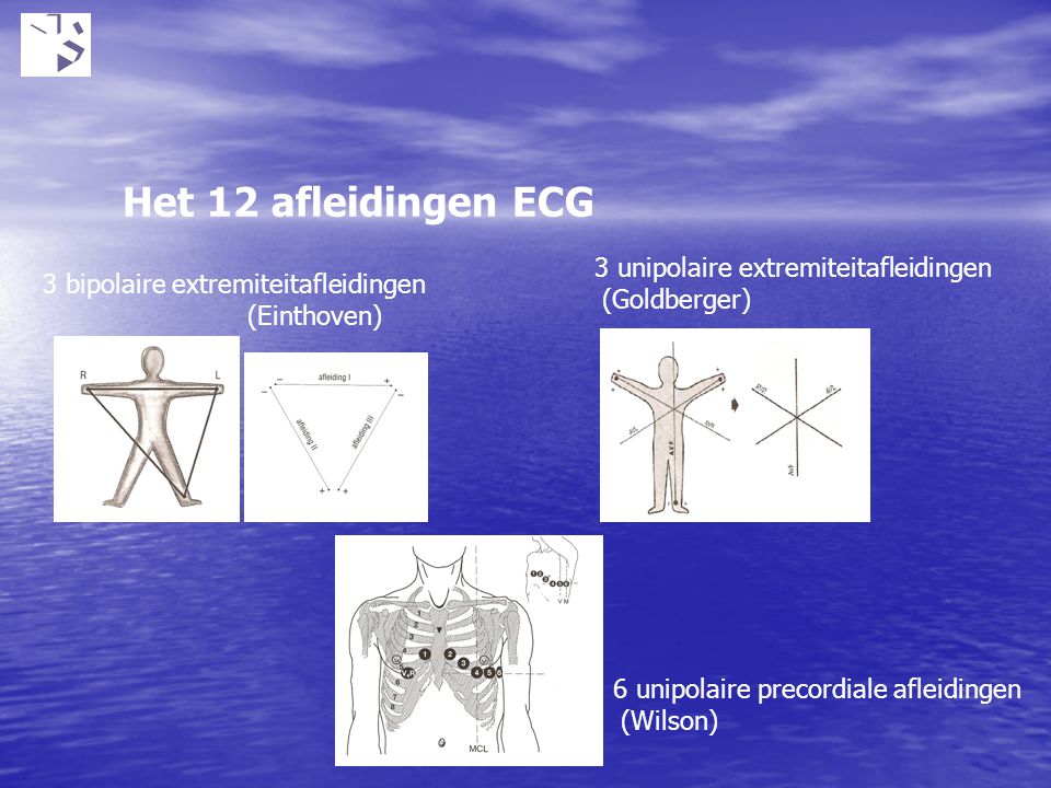 Het 12 afleidingen ECG 3 unipolaire extremiteitafleidingen