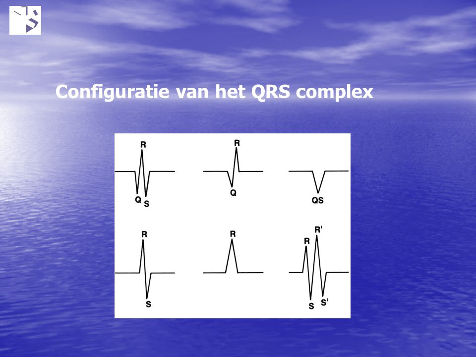 Configuratie van het QRS complex