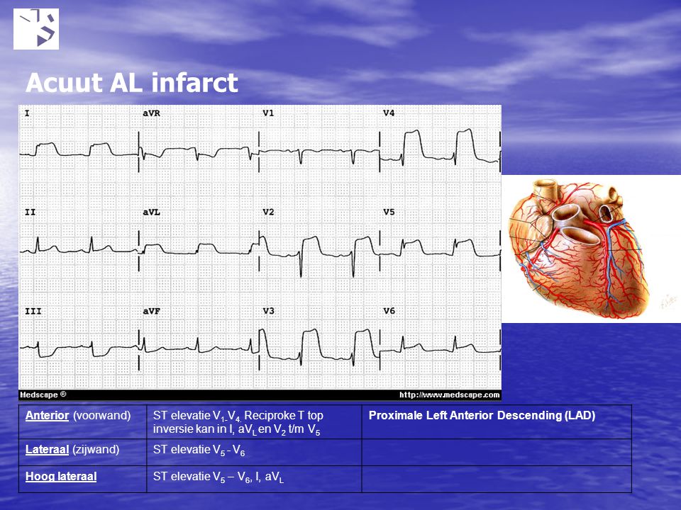 Acuut AL infarct Ontstaat door nierfunctie stoornissen bijv tgv medicatie gebruik. Bij kalium boven 5.5 mmol kunnen hartritmestoornissen voorkomen.