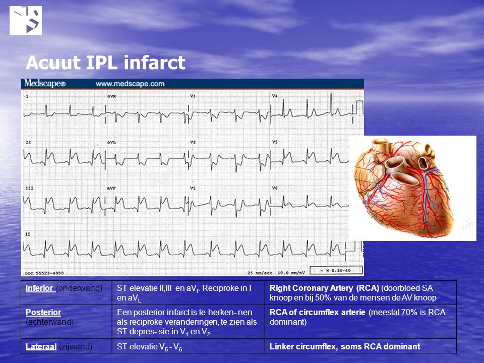 Acuut IPL infarct Ontstaat door nierfunctie stoornissen bijv tgv medicatie gebruik. Bij kalium boven 5.5 mmol kunnen hartritmestoornissen voorkomen.