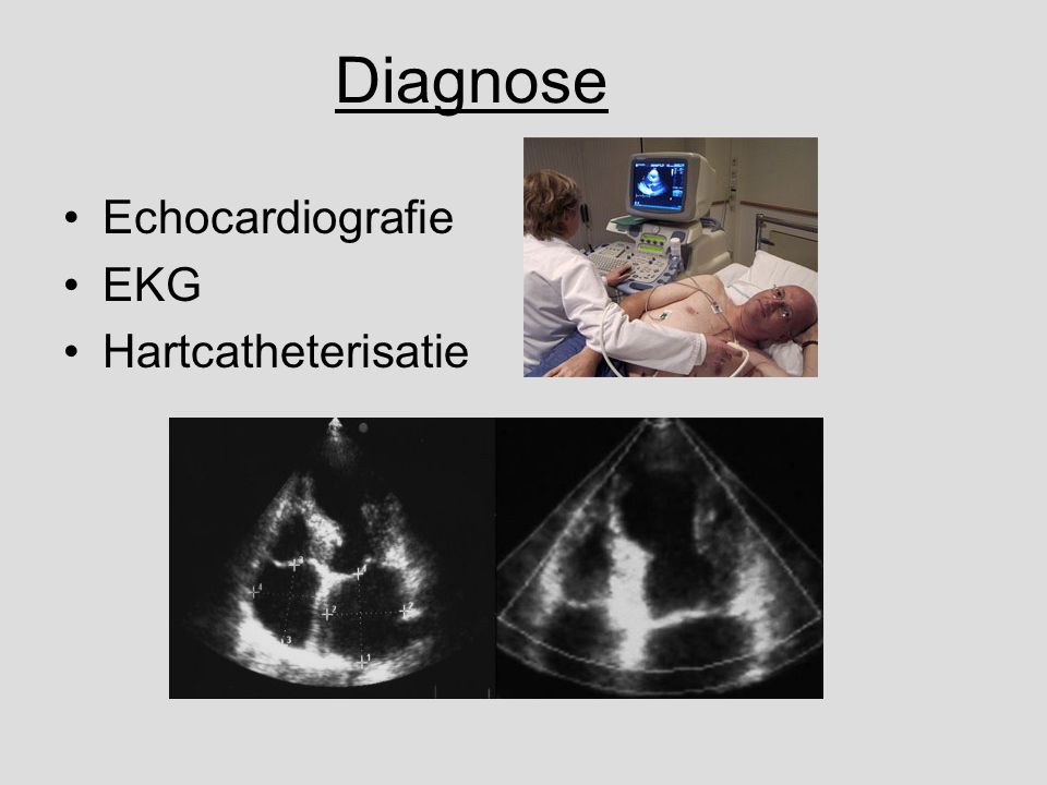 Diagnose Echocardiografie EKG Hartcatheterisatie