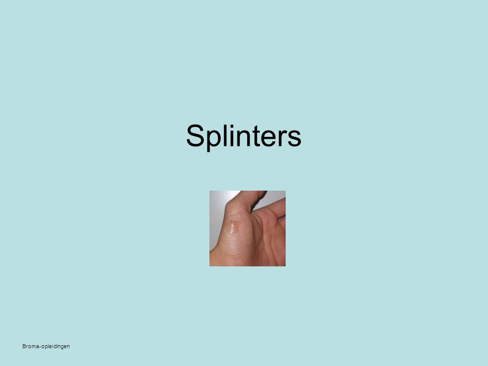Splinters Broma-opleidingen