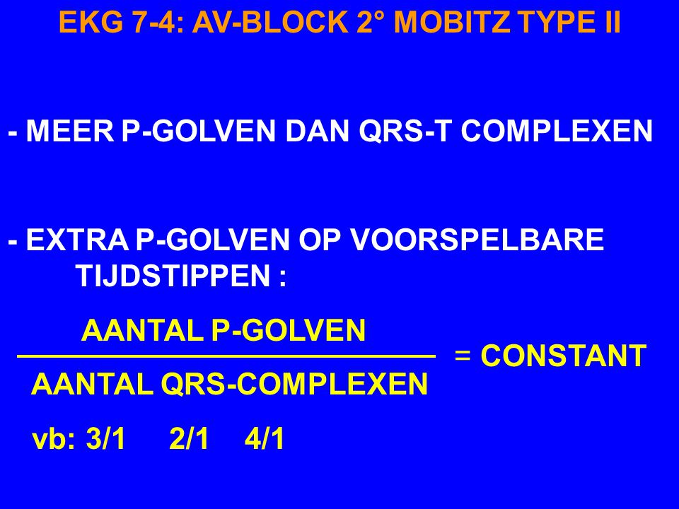 EKG 7-4: AV-BLOCK 2° MOBITZ TYPE II