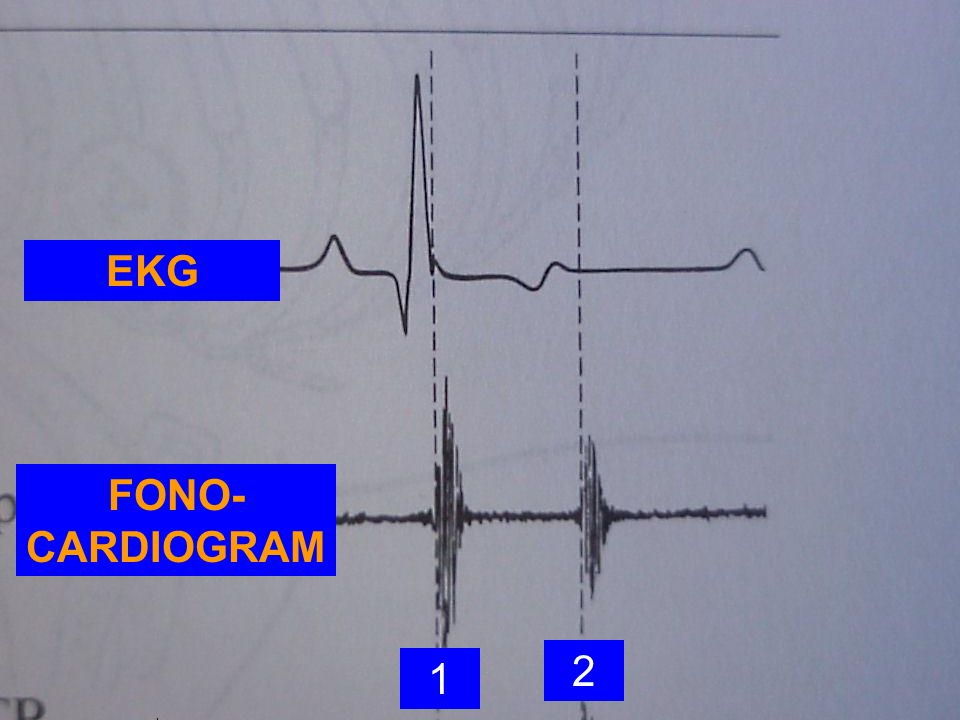 EKG FONO-CARDIOGRAM 2 1
