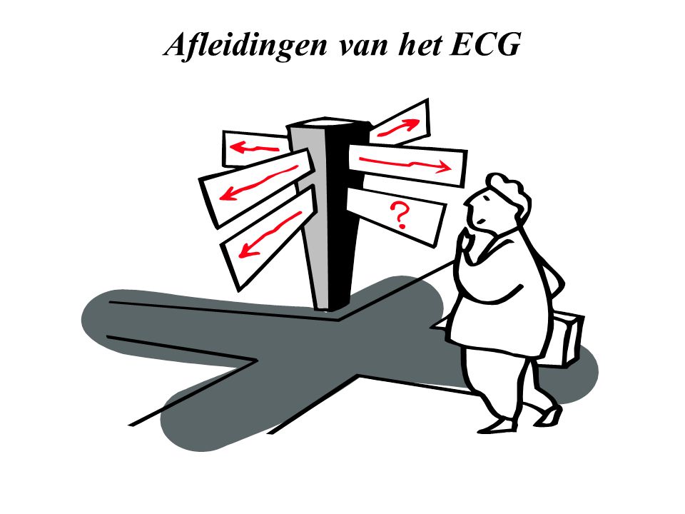 Afleidingen van het ECG