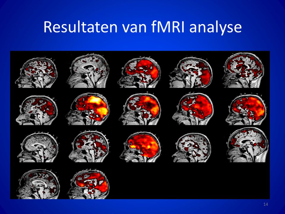 Resultaten van fMRI analyse