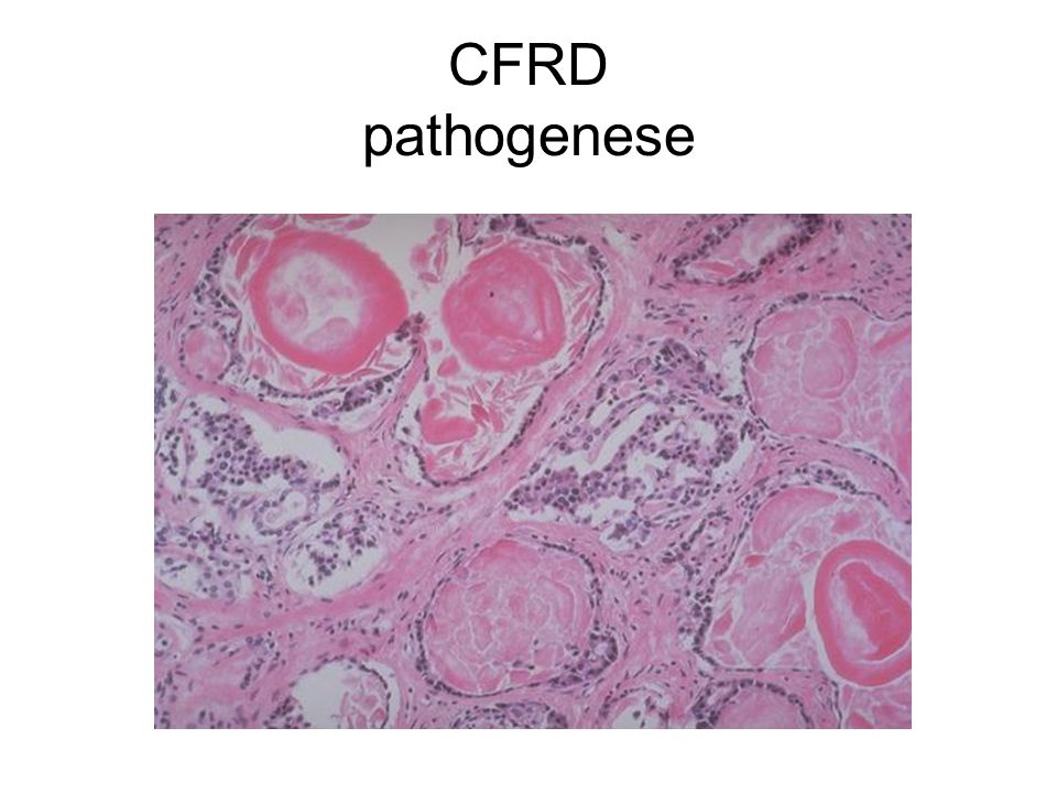 CFRD pathogenese