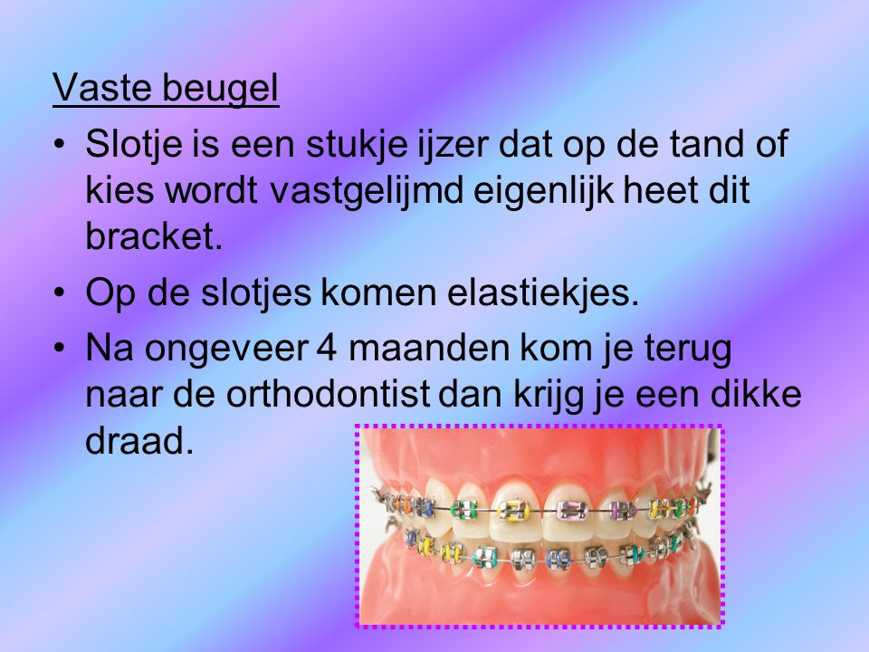 Vaste beugel Slotje is een stukje ijzer dat op de tand of kies wordt vastgelijmd eigenlijk heet dit bracket.