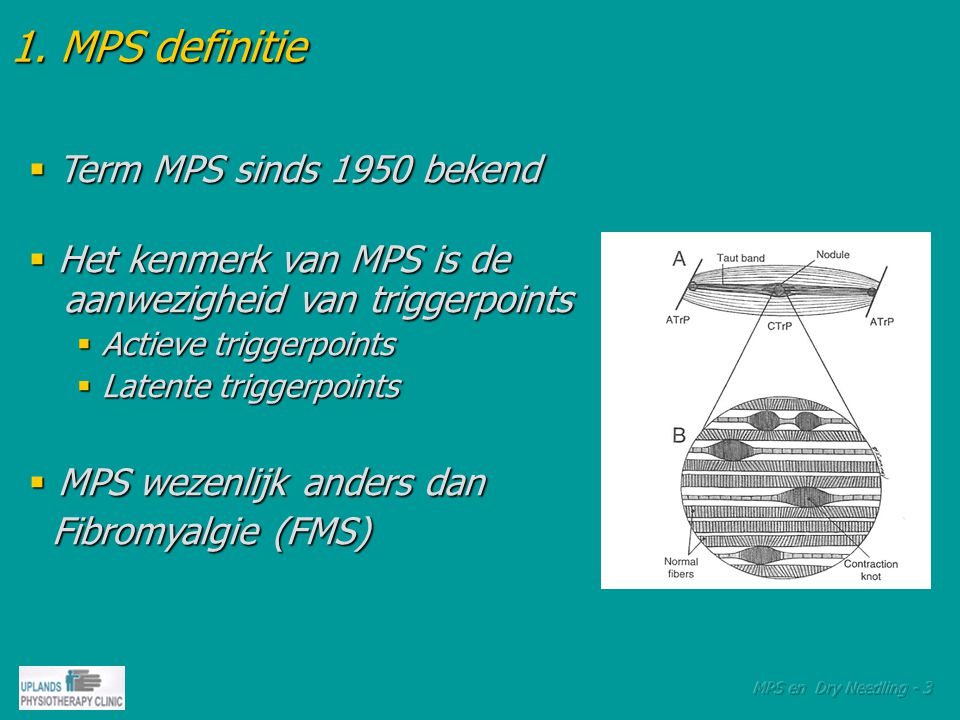 1. MPS definitie Term MPS sinds 1950 bekend