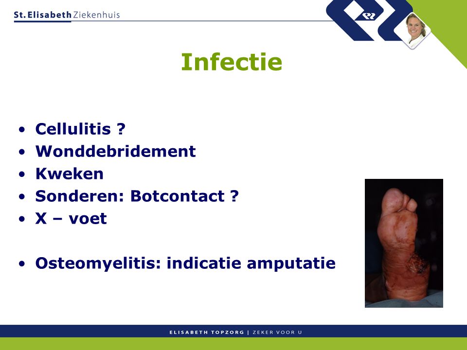 Infectie Cellulitis Wonddebridement Kweken Sonderen: Botcontact