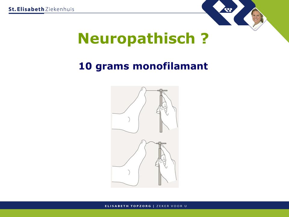Neuropathisch 10 grams monofilamant