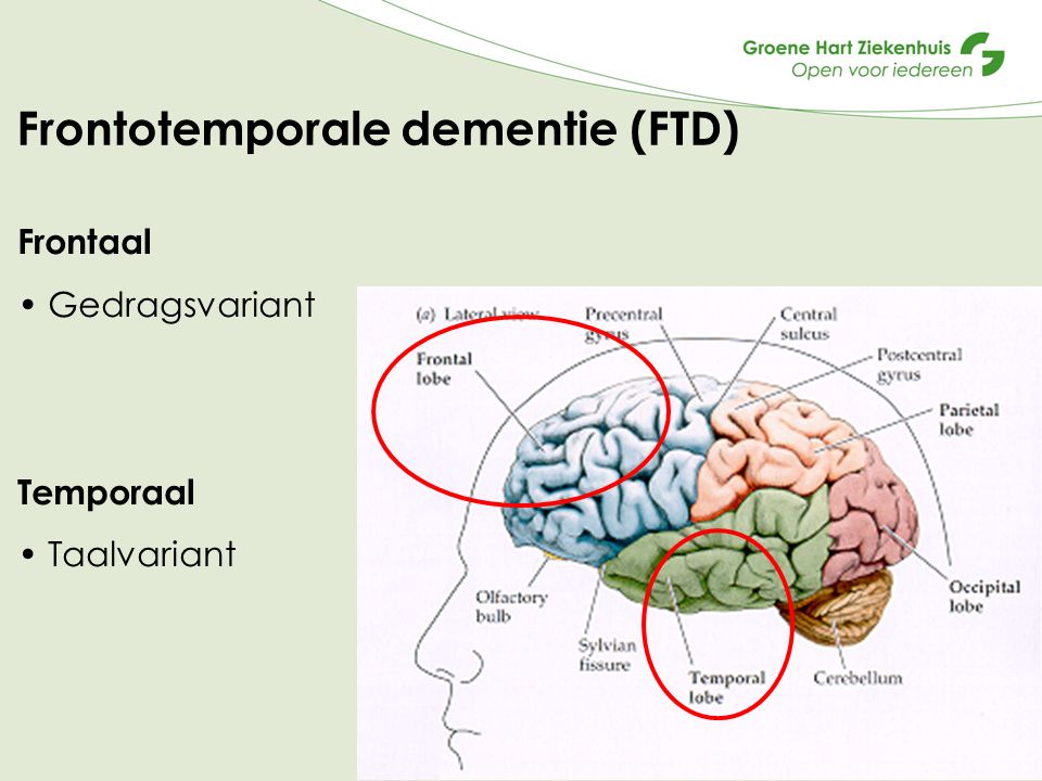 Frontotemporale dementie (FTD)