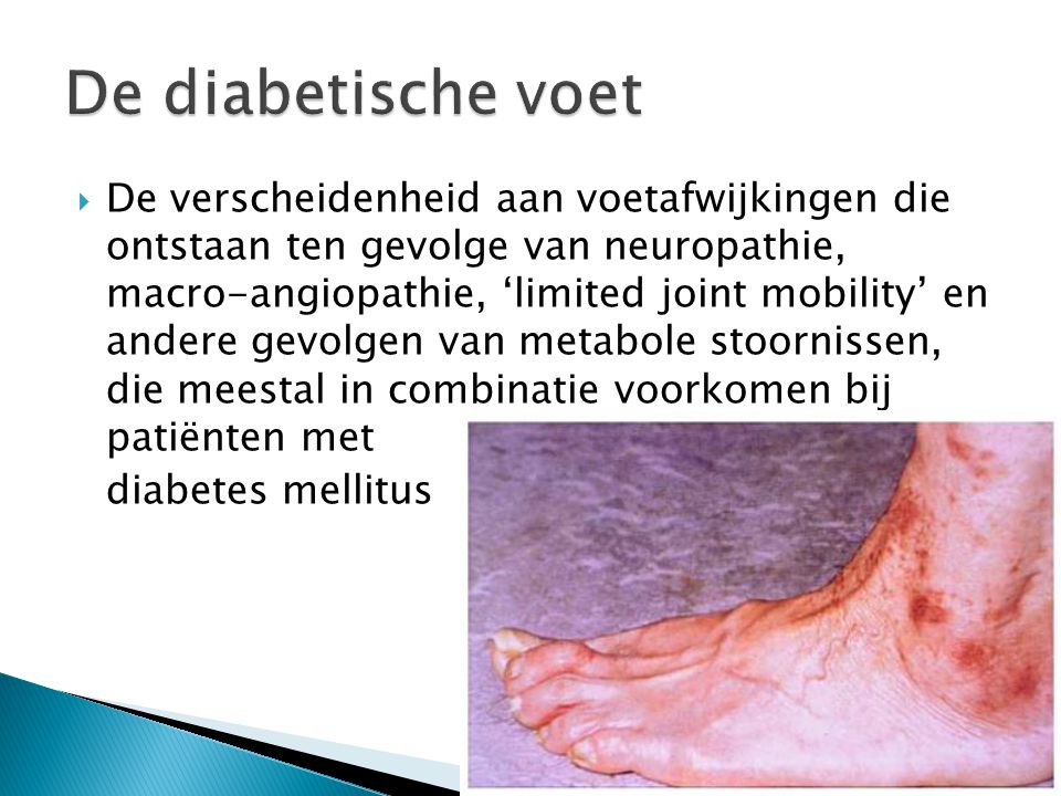 De diabetische voet