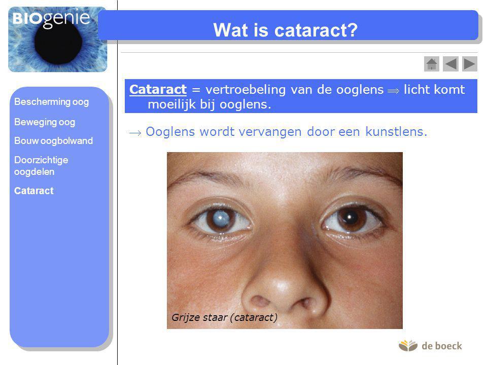 Wat is cataract Cataract = vertroebeling van de ooglens  licht komt moeilijk bij ooglens. Bescherming oog.
