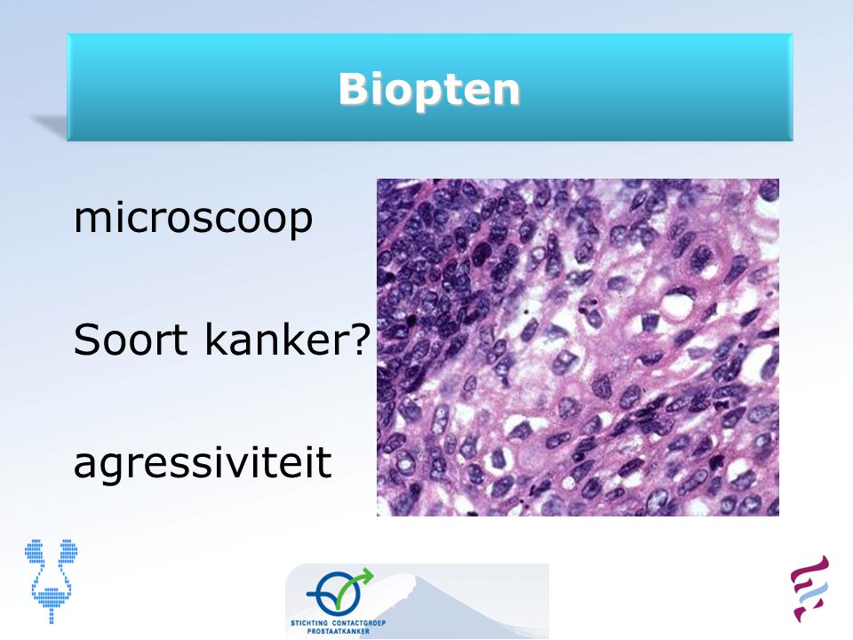 Biopten microscoop Soort kanker agressiviteit 10