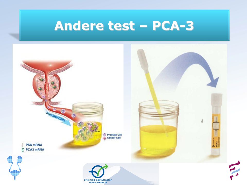 Andere test – PCA-3 11