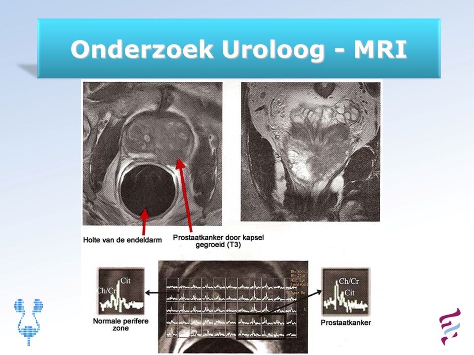 Onderzoek Uroloog - MRI