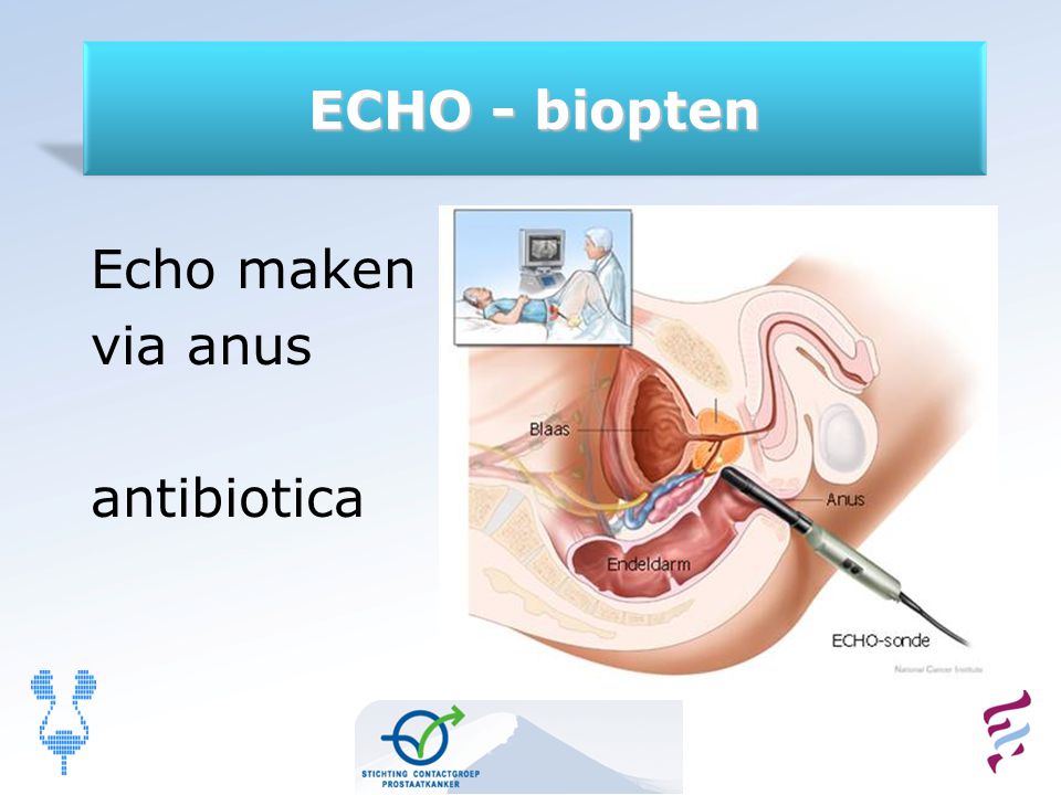 ECHO - biopten Echo maken via anus antibiotica 9