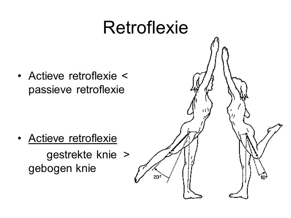 Retroflexie Actieve retroflexie < passieve retroflexie