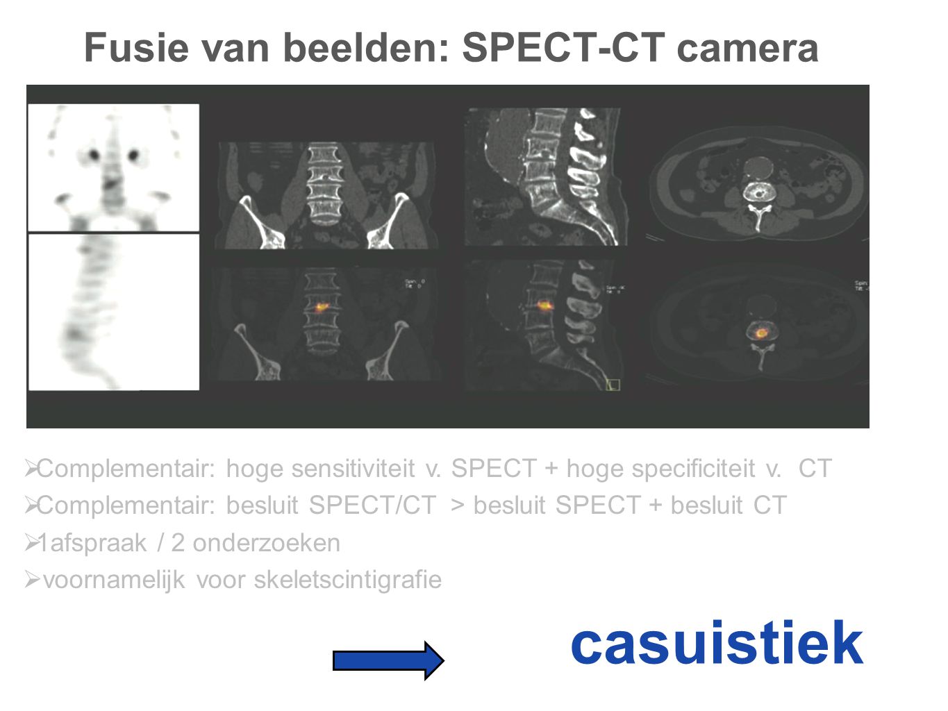 Fusie van beelden: SPECT-CT camera