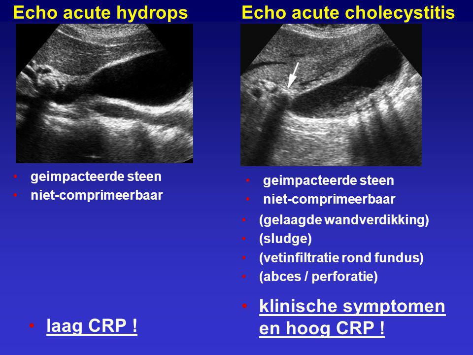 Echo acute cholecystitis