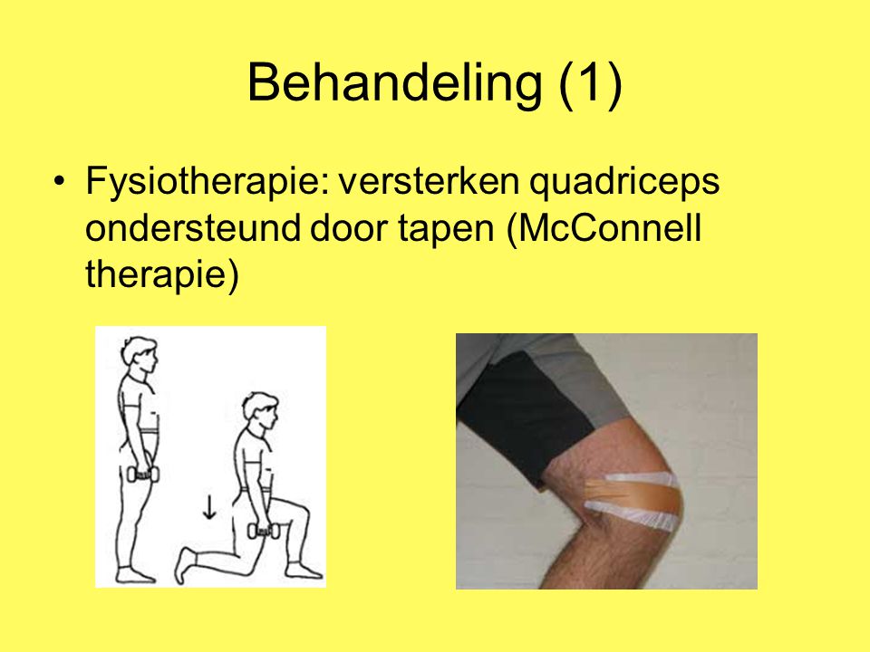 Behandeling (1) Fysiotherapie: versterken quadriceps ondersteund door tapen (McConnell therapie)