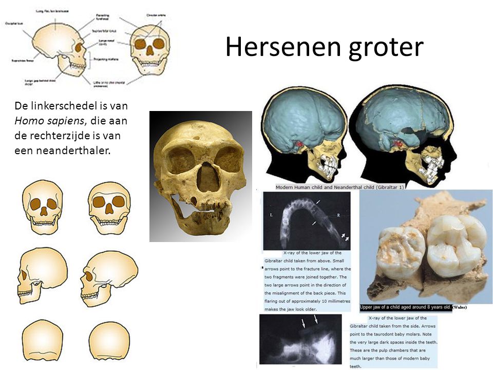 Hersenen groter De linkerschedel is van Homo sapiens, die aan de rechterzijde is van een neanderthaler.