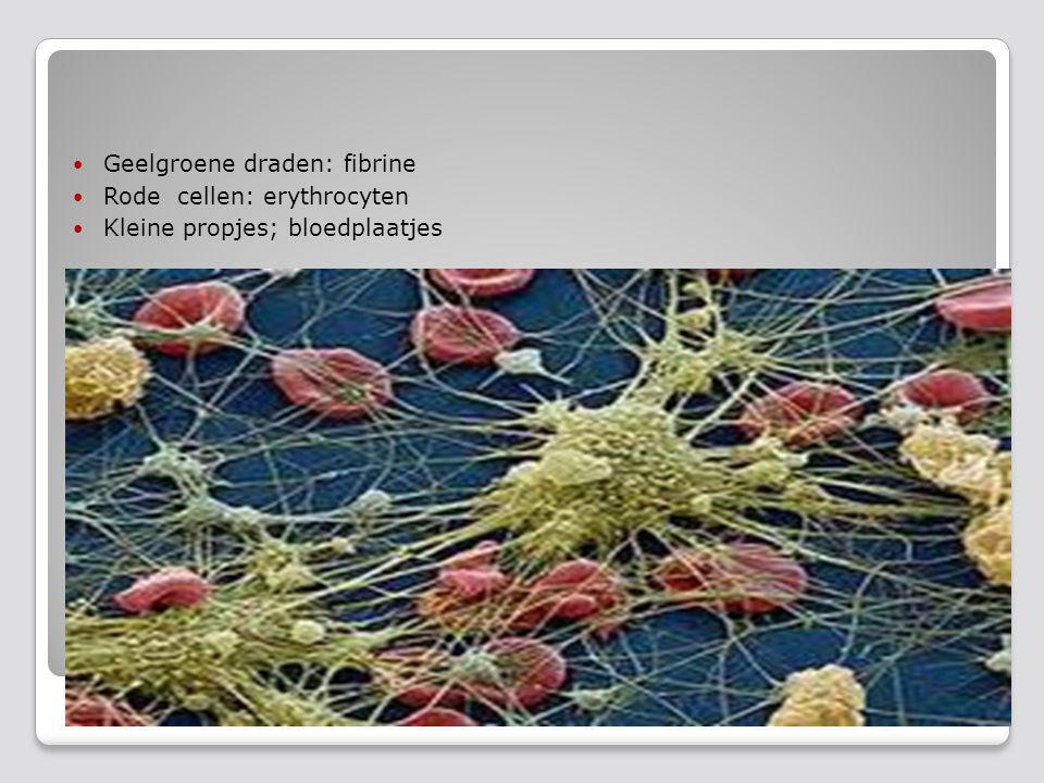 fibrinenetwerk Geelgroene draden: fibrine Rode cellen: erythrocyten