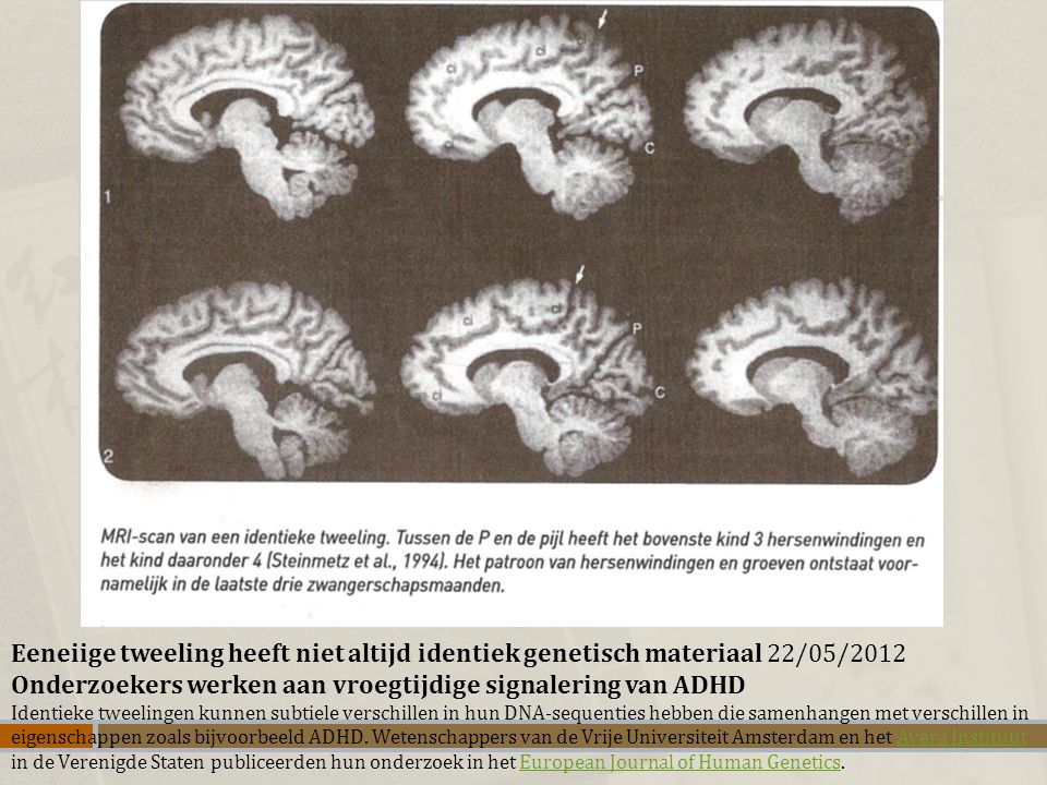Onderzoekers werken aan vroegtijdige signalering van ADHD