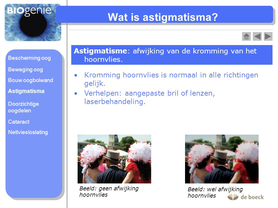 Wat is astigmatisma Astigmatisme: afwijking van de kromming van het hoornvlies. Bescherming oog. Beweging oog.