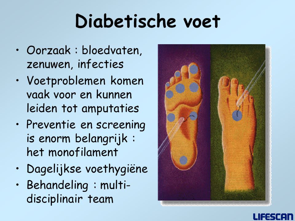 Diabetische voet Oorzaak : bloedvaten, zenuwen, infecties
