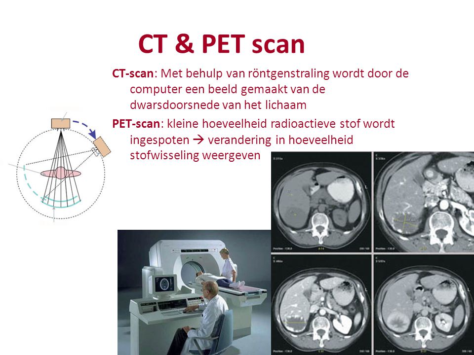 CT & PET scan CT-scan: Met behulp van röntgenstraling wordt door de computer een beeld gemaakt van de dwarsdoorsnede van het lichaam.