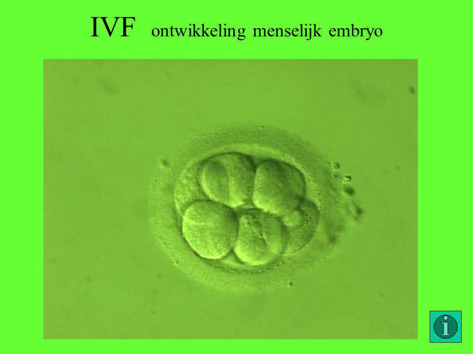 IVF ontwikkeling menselijk embryo